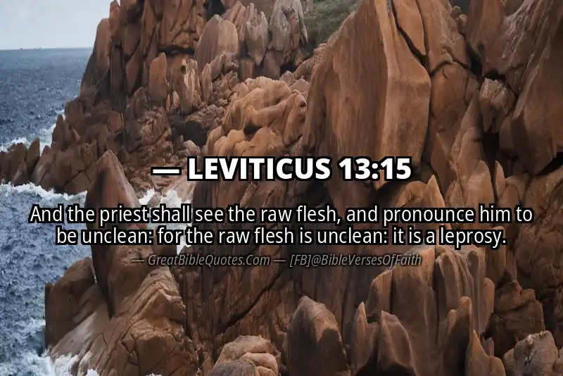 LEVITICUS 13:15 Verse